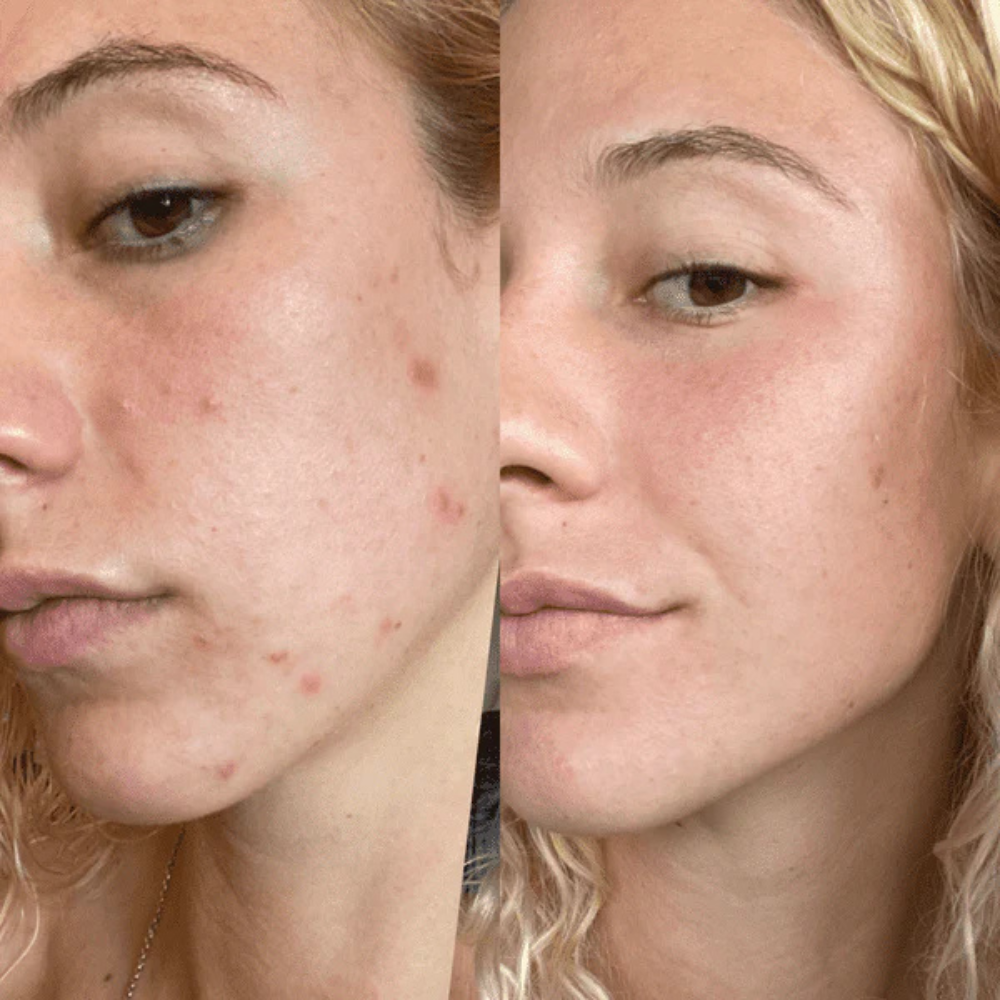 image comparison before