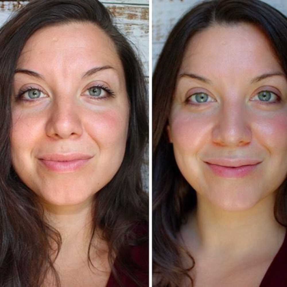 image comparison before