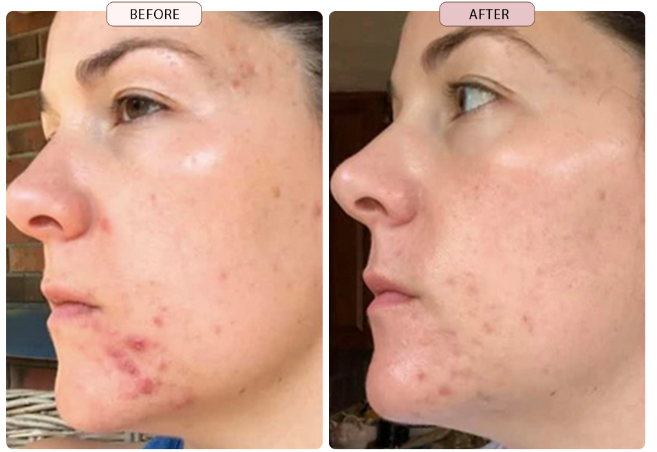 Pigment Perfecting Serum