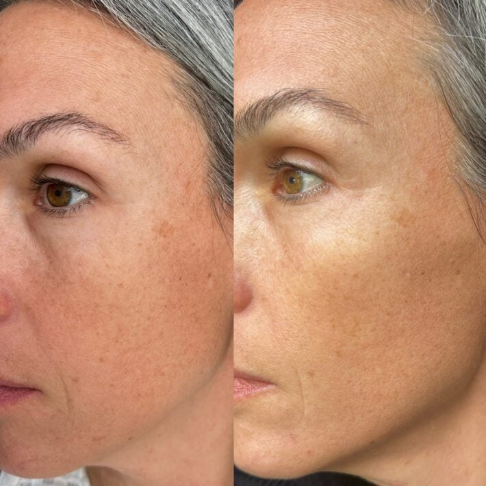 Pigment Perfecting Serum