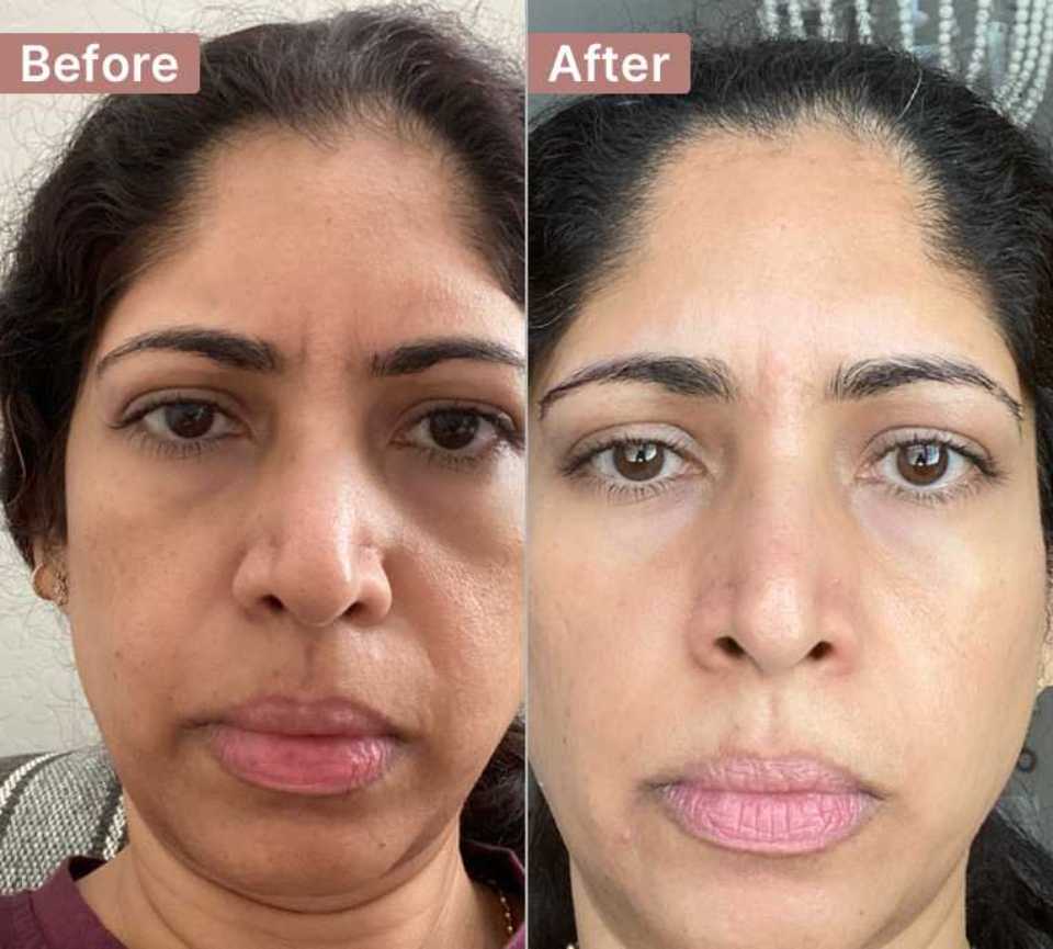 Peptide Anti-Aging Serum