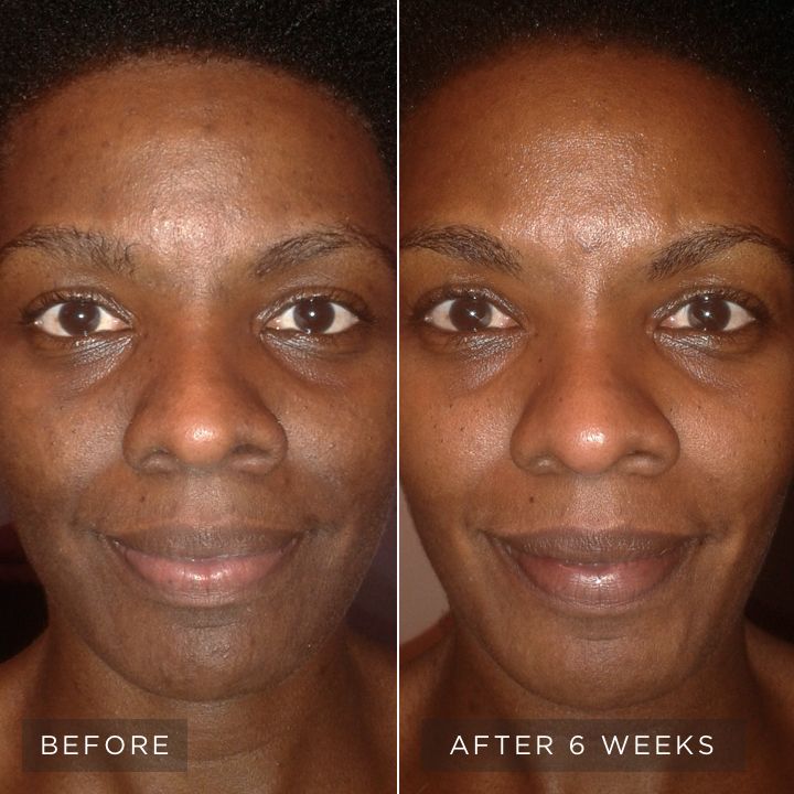 Pigment Perfecting Serum