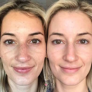 Peptide Anti-Aging Serum